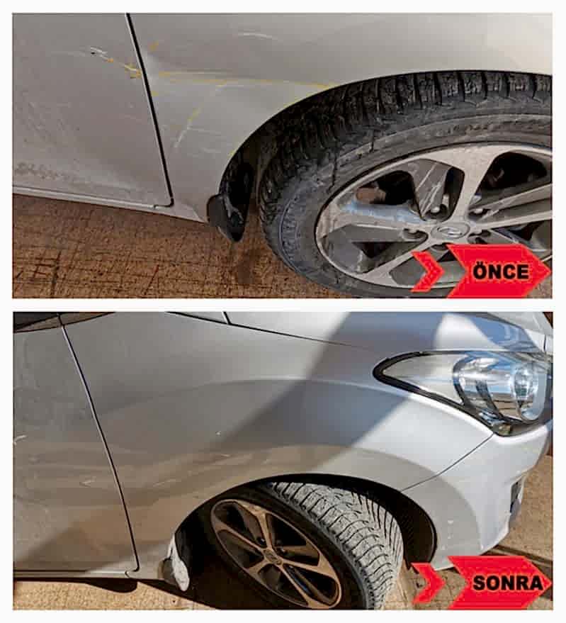 Hyundai Sağ Ön Çamurluk Boyasız Onarım